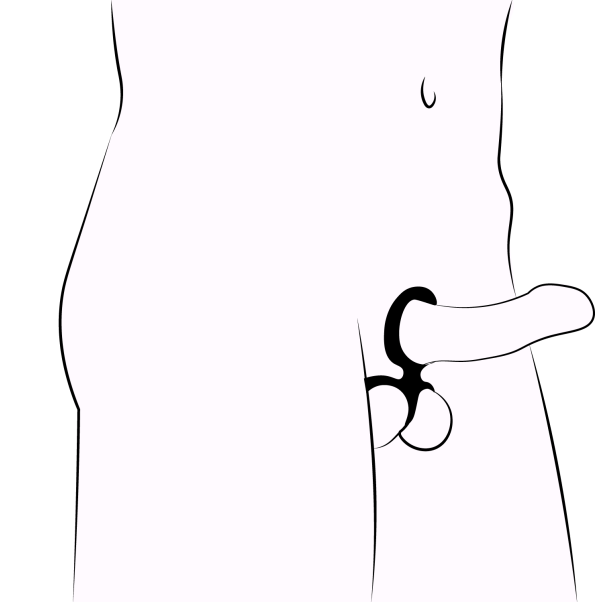 CalExotics Silicone Ball Spreider Cockring