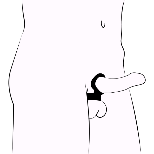 CalExotics Tri-Snap Scrotum Support Verstelbare Cockring