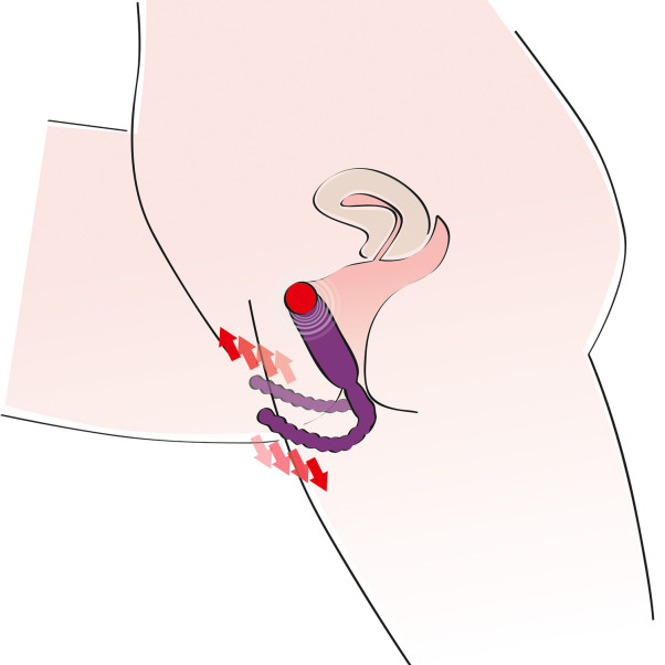 You2Toys Intieme Spreider met G-Spot Vibrator