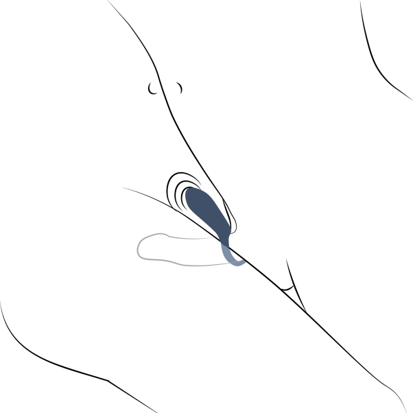 Amaysin Oplaadbare Vibrerende Cockring