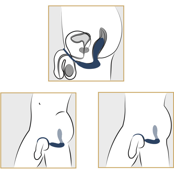 You2Toys Vibrerende Prostaatstimulator met Penisring